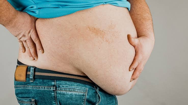 The Hidden Dangers of Obesity and How to Prevent Them